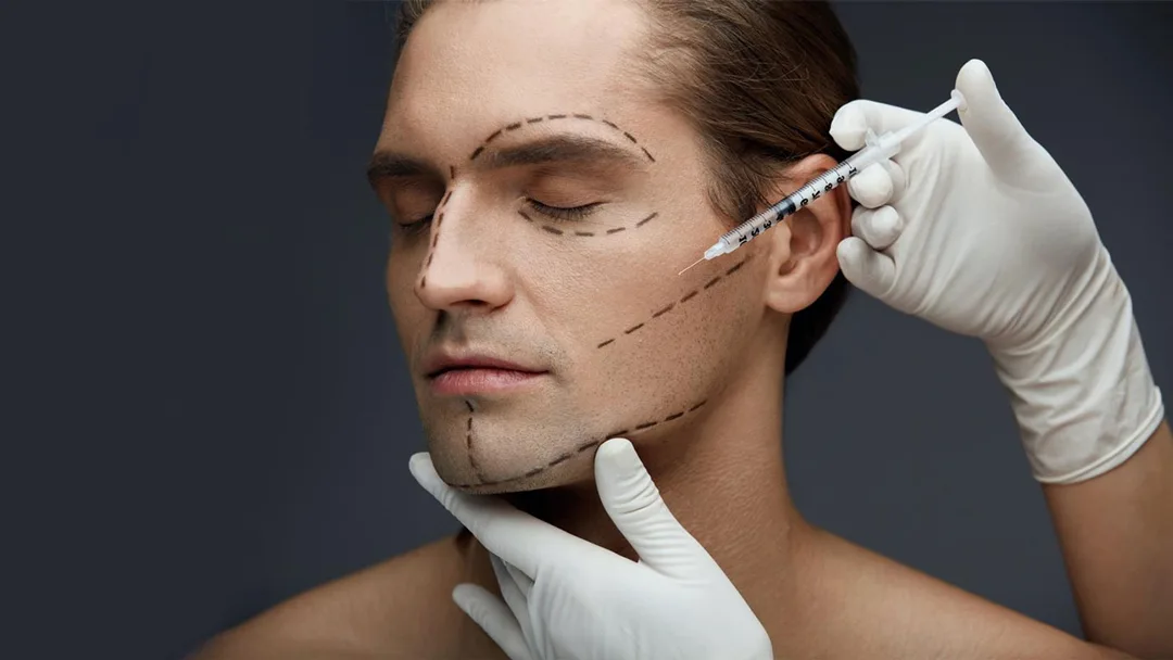 Cosmetic injectable treatment — guide markings on face